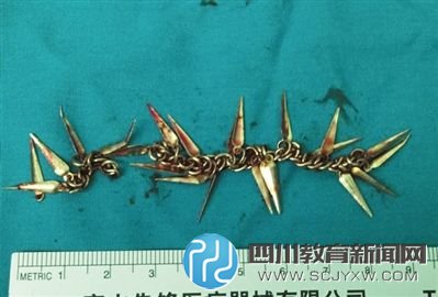 兒童誤食的金屬鏈，長(zhǎng)約9厘米。北京兒童醫(yī)院供圖