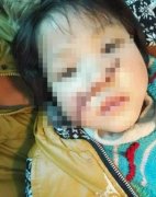 看動畫片要注意！10歲女孩模仿光頭強將